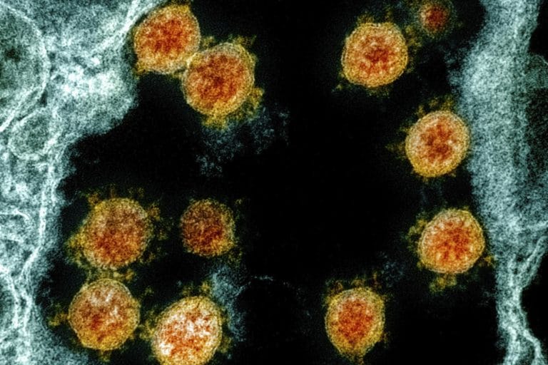 СМИ Австрии: действительно ли Sars-CoV-2 становится более заразным, но слабым?