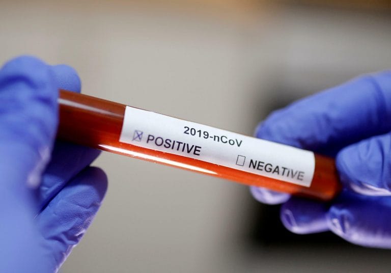 СМИ Австрии: Roche запустила более дешёвый и быстрый экспресс-тест на коронавирус